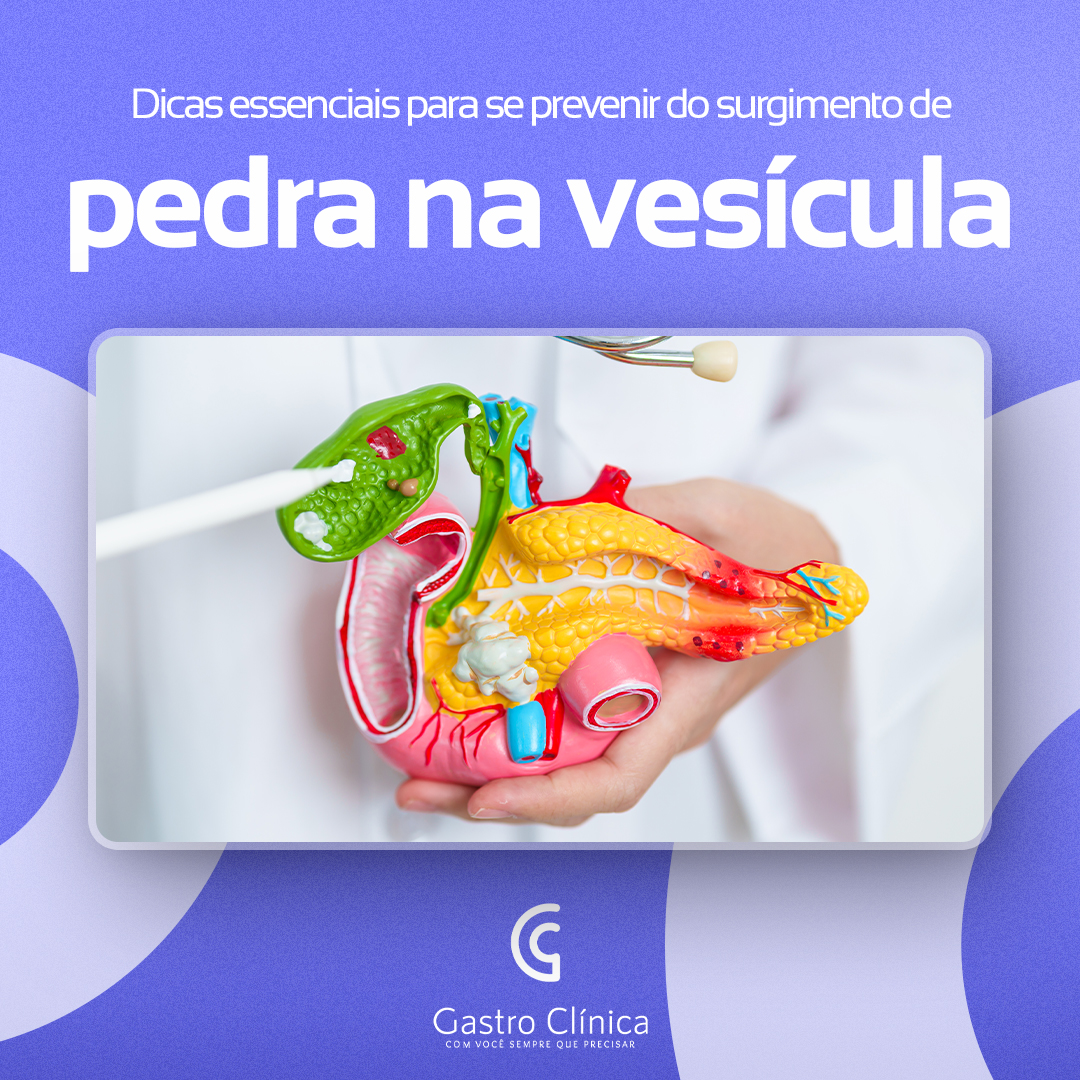 Imagem postagem Dicas para prevenir pedras na vesícula